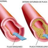 ¿Qué tan importante es el Omega-3 para nuestra salud?